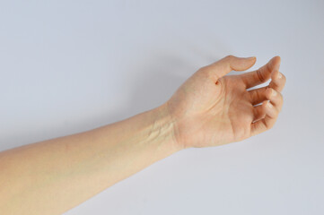 Visible blood vessels appear around arm wrist in white background