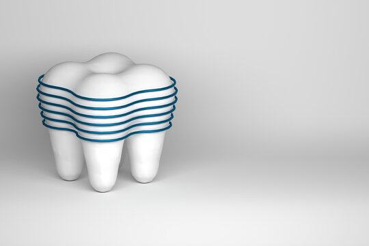 OnOne white tooth with abstract protective blue wires. Image with copy blank space