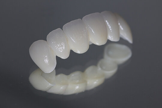 Zirconia bridge with all-porcelain. Zirconium crown