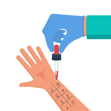 Allergy test. Doctor holds pipette in hand for research. Medical vector illustration flat design. Laboratory equipment for analysis. Patient with an allergic reaction. Isolated on white background.