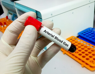 Blood sample tube for arterial blood gas test