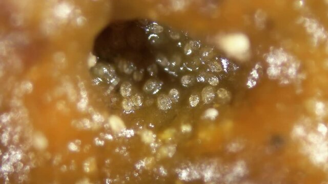 Soil mites of the Acaridae family under a microscope. saprophages feed on rotten organic debris, mold. There are types of pests that damage flower bulbs and grains.