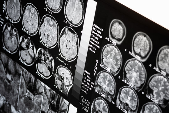 MRI of  brain of a healthy person. Magnetic resonance scan. Medical healthcare concept