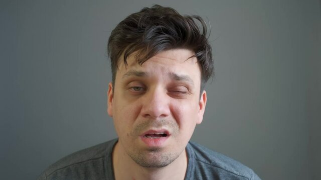 Man with hangover waking up sitting in bed feeling terrible headache looking at camera. Drug and alcoholism addiction, human bad habits. Morning after a great party.
