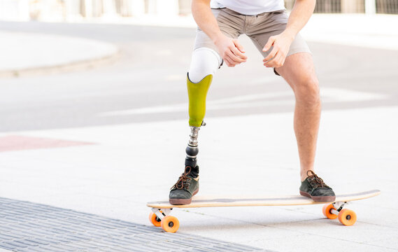 Young man with disability skateboarding on street