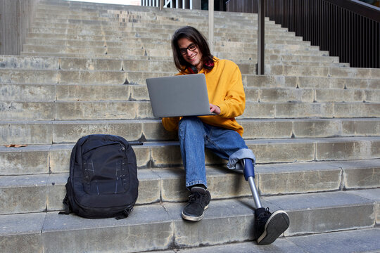 Smiling man with leg prosthesis using laptop while sitting on steps