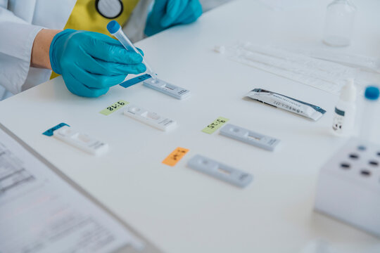 Expertise putting sample on test cassettes while working at examination room