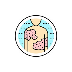 Urticaria color line icon. Dermatology disease. Isolated vector element.