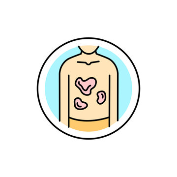 Pityriasis rosea color line icon. Dermatology disease. Isolated vector element.