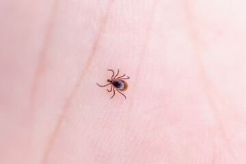 The tick sits on the human body.