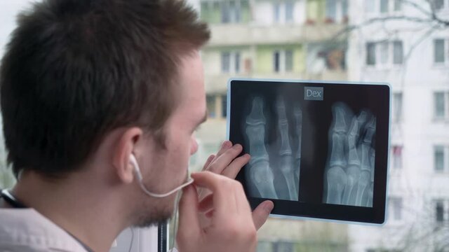 Young doctor looking at a x-ray picture, against the background of a window, against the background of a building, the concept of therapy and a doctor