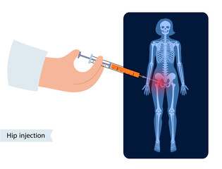 Hip joint injection