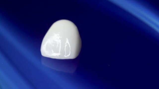 A macro close-up shot of Dental veneers on isolated blue background. Medical veneers are special tooth pads as aesthetic function. Modern precision manufacturing you to create the perfect smile