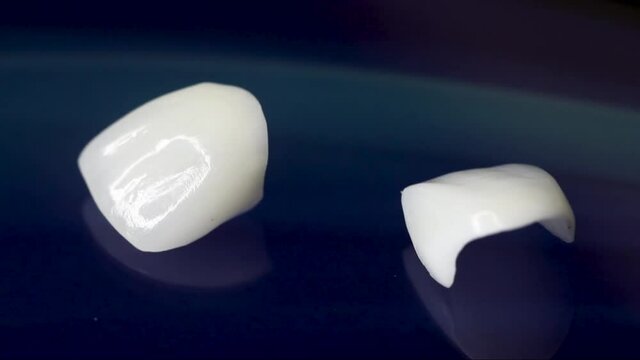 A macro close-up shot of Dental veneers on isolated blue background. Medical veneers are special tooth pads as aesthetic function. Modern precision manufacturing you to create the perfect smile