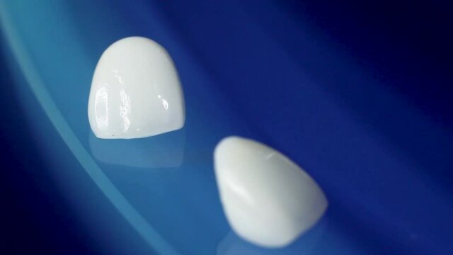 A macro close-up shot of Dental veneers on isolated blue background. Medical veneers are special tooth pads as aesthetic function. Modern precision manufacturing you to create the perfect smile