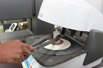 Pressing the new teeth with ingot material in the oven