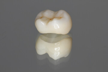 Zirconia crown with all porcelain baked. 