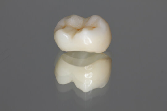Zirconia crown with all porcelain baked. 