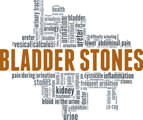 Bladder stones vector illustration word cloud isolated on a white background.