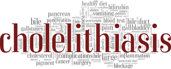 Cholelithiasis vector illustration word cloud isolated on a white background.