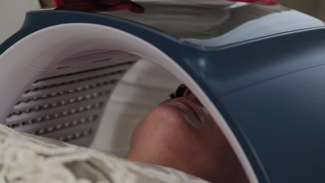 Woman beautician connects and adjusts the device for photo peeling.