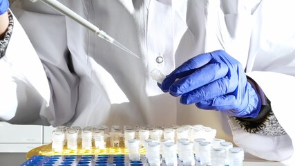 Laboratory researcher or nurse pipets patient sample into a test tube. Genetic engineering or...