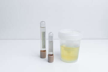 Espoo. Finland. 06 May 2021 Urine tests in medical tubes