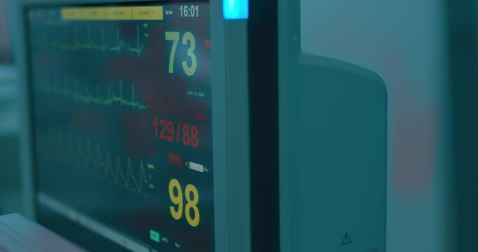 Close-up patient's monitor screen with diagrams: electrocardiogram, pulse oxygen saturation, non-invasive blood pressure.
