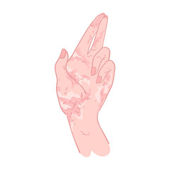 Inflammation skin of female hand with dermatitis, red spots and peeling