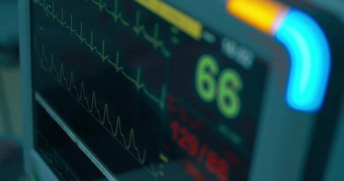 Close-up a patient monitor screen with some diagrams which are indicating the patient&rsquo;s vital signs such as his heartbeat, blood pressure, level of oxygen.