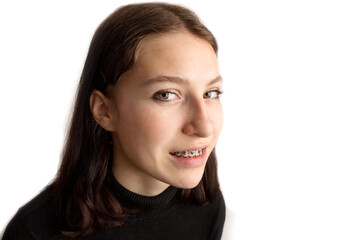 Orthodontic treatment. Dental care concept. Smiling teenage girl with braces. Metal braces close-up...