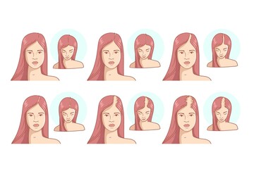 Flat Hand Drawn Hair Loss Stages Illustration