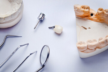 dental implant crown on white background with plaster models and dental instruments, probe, mirror and tweezers