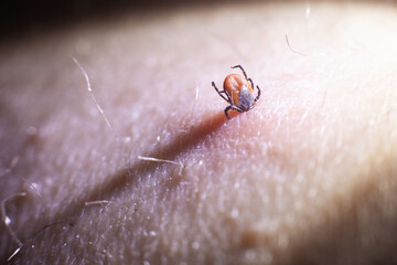 Insect mite began to be sucked on human skin. macro