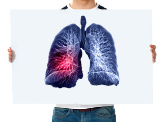 Man holding white poster  with 3D rendering image of lung.
