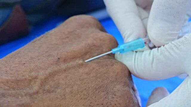 Close up doctor hand practice  intravenous injection