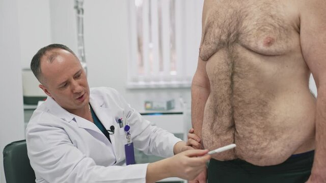 Plastic Doctor Shows The Abdominal Of An Overweight Patient. Surgeon Speaks About Problem Parts On A Belly Of A Patient Man. The Result Of Weight Loss.