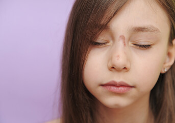 The child fell and bumped. Abrasions on the face 