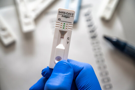 Auswertung von Covid 19 Schnelltest in einem Labor