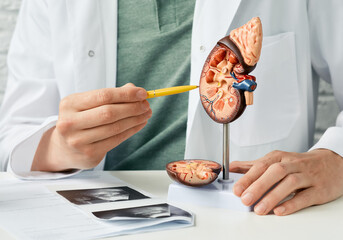 Urology and treatment of kidney disease. Doctor analyzing of patient kidney health using kidney...