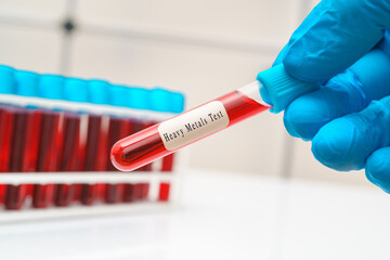 Blood sample   test tube in doctor hand for  heavy metals  test