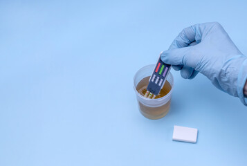 a woman's hand drops test strips into a jar of urine to detect illegal drugs and alcohol in the human body © Irina