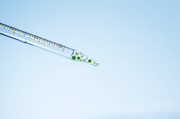 Medical laboratory. A pipette with a clear liquid and a virus on a blue background. Laboratory...