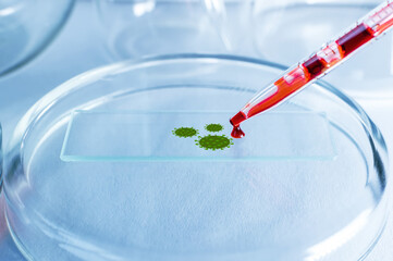 Medical laboratory. Blood with the virus from a pipette is poured onto a glass plate for analysis....