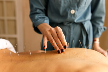 Fototapeta na wymiar Close up image of female hand sticking fine acupuncture needle to strategic trigger points on patient’s back. Traditional Chinese medicine, treatment, health, therapy and wellness concept