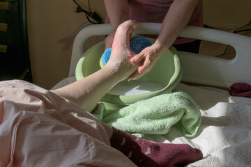 Washing the feet of a bedridden patient. A caregiver washes the leg of a patient with the syndrome. A basin with a washcloth. Concept of caring for a bedridden patient with dementia, stroke.
