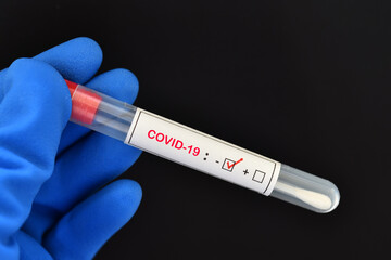 Nasopharyngeal swab negative with COVID-19 test 
