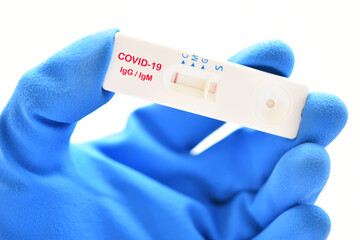 COVID-19 rapid test for IgM and IgG antibody detection, the result showed negative both IgM and IgG 