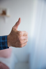 male vitiligo hand shows great class