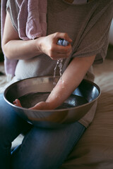 Woman treating burns on her hand, applying cold water on injured skin